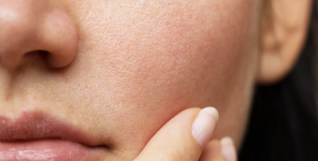 Face Yoga Skin